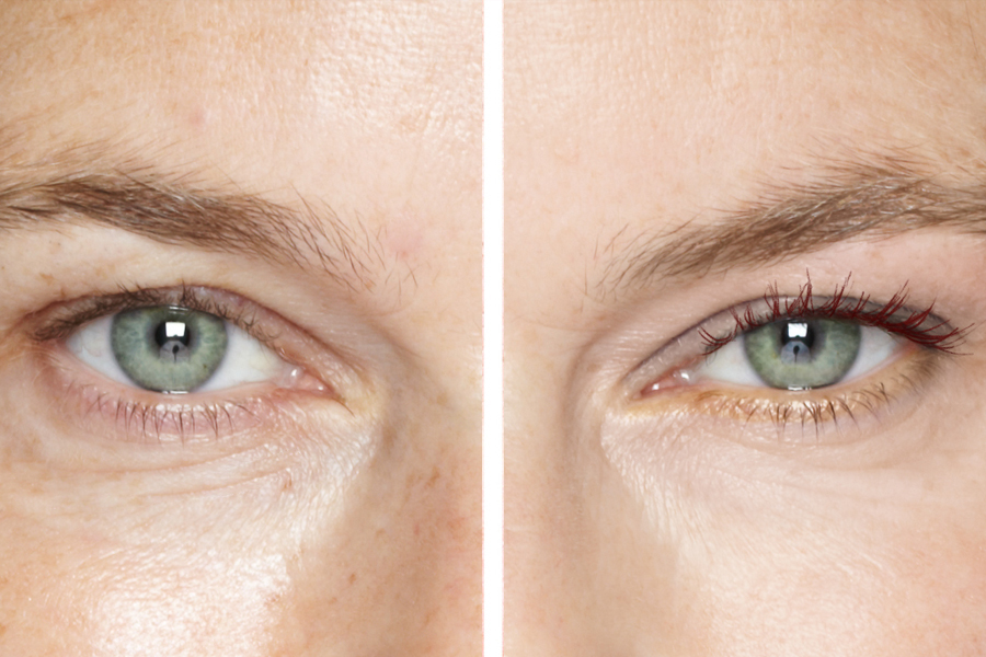 tratamiento para refinar el contorno de ojos